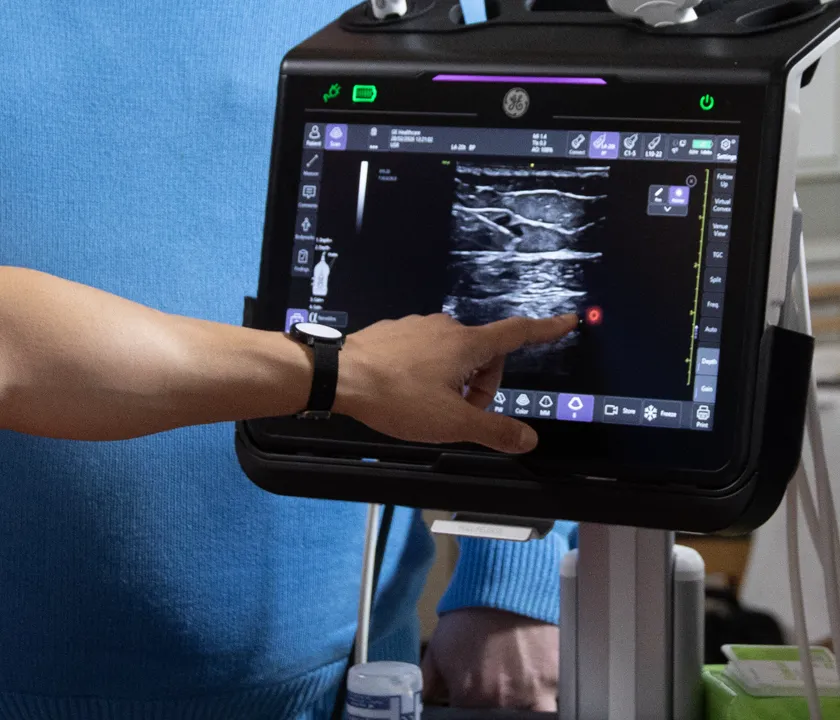 Live ultrasound scanning monitor